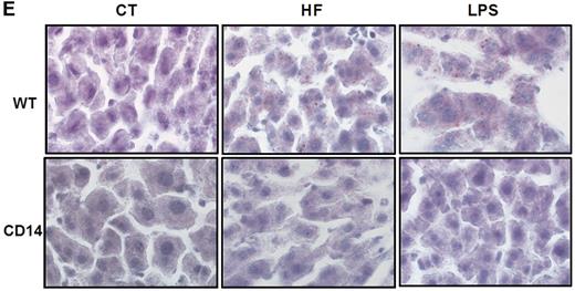 FIG. 6. CD14: the main LPS receptor sets the tone of insulin sensitivity and hepatic steatosis. A: Glucose turnover (mg · kg−1 · min−1) in WT mice or CD14 mutant fed a normal diet (CT) or fed a high-fat diet (HF) for 4 (n = 8) or 24 (n = 8) weeks (wks). B: Body weight gain (g) in WT or CD14 mutant fed a normal diet (CT) for 4 (n = 8) or 24 (n = 8) weeks or fed a high-fat diet (HF) for 4 (n = 8) or 24 (n = 8) weeks. C: Liver weight (percent of body weight) in WT or CD14 mutant mice fed a normal diet (CT) for 4 (n = 8) or 24 (n = 8) weeks or fed a high-fat diet (HF) for 4 (n = 8) or 24 (n = 8) weeks. D: Liver triglycerides (μmol/liver) in WT or CD14 mutant mice fed a normal diet (CT) for 4 (n = 6) or 24 (n = 5) weeks or fed a high-fat diet (HF) for 4 (n = 5) or 24 (n = 5) weeks. Data are means ± SE. *P < 0.05 vs. CT; §P < 0.05 vs. WT. E: Representative oil red O liver staining in 4-week–treated mice. F (see next page): Plasma glucose following an intraperitoneal glucose load (1 g/kg) in WT mice fed a normal diet (WT-CT; n = 8) or a high-fat diet (WT-HF; n = 8) for 24 weeks and CD14 mutant mice fed a normal diet (CD14-CT; n = 8) or fed a high-fat diet (CD14-HF; n = 8). The inset represents the area under curve of the same groups. G (see next page): Fasting plasma insulin (pmol/l) in WT or CD14 mutant mice fed a normal diet (CT) for 4 (n = 6) or 24 (n = 5) weeks or fed a high-fat diet (HF) for 4 (n = 5) or 24 (n = 5) weeks. Data are means ± SE. *P < 0.05 vs. CT; §P < 0.05 vs. WT. Data with different superscript letters are significantly different at P < 0.05, according to the post hoc ANOVA statistical analysis.