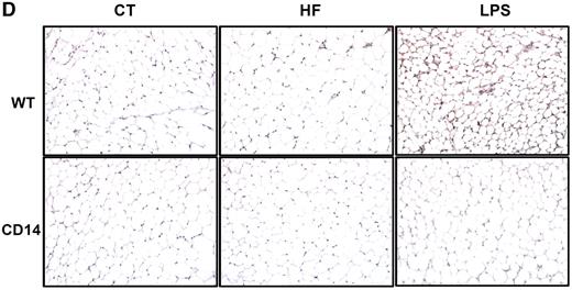 FIG. 8. Metabolic endotoxemia impairs adipocyte morphology. A: Adipocyte size distribution (%) in WT mice fed a normal diet (WT-CT; n = 765) (□) or a high-fat diet (WT-HF; n = 661) (▪) for 4 weeks or CD14 mutant mice fed a normal diet (CD14-CT; n = 1,032) ( ▒) or a high-fat diet (CD14-HF; n = 729) () for 4 weeks. B: Adipocyte size distribution (%) in WT mice infused with saline (WT-CT; n = 765) (□) or LPS (WT-LPS; n = 750) (▪) and CD14 mutant mice infused with saline (CD14-CT; n = 1,032) (▒) or LPS (CD14-LPS; n = 585) () for 4 weeks using subcutaneous osmotic pumps. C: Adipocyte mean area (μm2) in WT-CT (n = 765), WT-HF (n = 661), WT-LPS (n = 750), CD14-CT (n = 1,032), CD14-HF (n = 729), or CD14-LPS (n = 585) mice. D: Representative adipose tissue staining in 4-week–treated mice. E: F4/80-positive cells (+ cells/total cells) of all above groups. Data are means ± SE. Data with different superscript letters are significantly different at P < 0.05, according to the post hoc ANOVA statistical analysis.