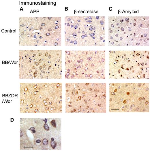 FIG. 3. Immunostainings of APP, β-secretase, and β-amyloid were increased in type 2 BBZDR/Wor rats (A, B, and C) and to a lesser extent in type 1 BB/Wor rats (A, B, and C), whereas the stainability was least evident in control rats (A, B, and C). APP and β-secretase showed a punctate staining pattern in diabetic animals. This is illustrated in D for APP. The bar in bottom panel of C corresponds to 50 μm, and the magnification for panels A, B, and C is the same. The bar in D corresponds to 25 μm.