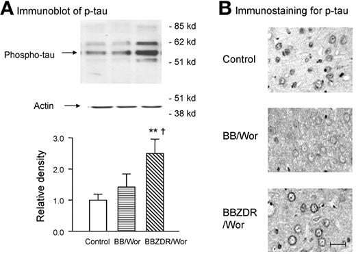 FIG. 4. Immunoblotting for phospho-τ (antibody PS-396) shows multiple bands representing phosphor-τ isoforms, which were significantly (P < 0.01) increased in the type 2 BBZDR/Wor rat (A). The expression in type 1 BB/Wor rats was not significantly increased (A). This corresponded to a stronger immunostainability in neuronal perikarya of layers II–III in type 2 diabetic rats, which was less evident in type 1 diabetic rats (B). Note an increased punctuate stainbility of the neuropil in diabetic rats possibly corresponding to increased phospho-τ in neurites. The bar corresponds 50 μm. **P < 0.01 vs. control rats; †P < 0.05 vs. BB/Wor rats.