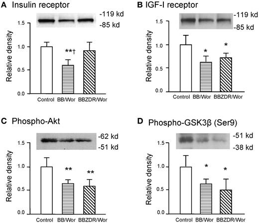 FIG. 5. The expression of insulin resistance was decreased in frontal cortex of type 1 but not in that of type 2 diabetic rats (A). IGF-1 receptor expression on the other hand was equally decreased in both diabetic models (B) as were the signal intermediaries phospho-Akt (C) and phosphorylated GSK-3β (Ser 9) (D). *P < 0.05, **P < 0.01 vs. control rats; †P < 0.05 vs. BBZDR/Wor rats.