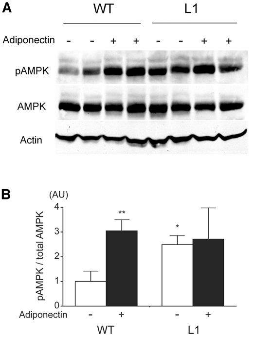 FIG. 4. Adiponectin-stimulated AMPKα phosphorylation in liver of 8-week-old wild-type (WT) and normoglycemic L1 mice. Mice were fasted for 6 h, intravenously injected with saline or adiponectin (2 μg/g body wt), and killed 20 min after injection. Representative phospho-Thr12 and total AMPKα immunoblots of liver lysates are shown. Ratio of phosphorylated versus total AMPKα was calculated and is shown as means ± SE. n = 4–6. *P < 0.05 vs. wild-type saline group; **P < 0.01 vs. wild-type saline group. AU, arbitrary units.