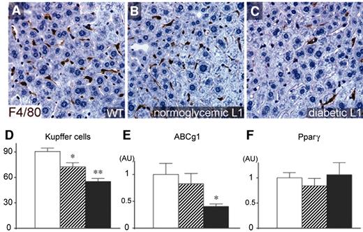 FIG. 6. Immunohistochemical and gene expression analyses of liver macrophages of wild-type and L1 mice. Kupffer cells were immunostained with F4/80 using DAB (brown). Representative images of wild-type (A), normoglycemic L1 (B), and diabetic L1 (C) mice are shown. D: Kupffer cells were quantified as number of F4/80-positive cells per five opitical fields (×40 objective) in each animal (n = 8 for each group). mRNA expression of ABCg1 (E) and Pparγ (F) was determined by quantitative RT-PCR in liver of wild-type, normoglycemic, and diabetic L1 mice (n = 6–8). Data were normalized against β-actin mRNA. Data are means ± SE. *P < 0.05 vs. wild type; **P < 0.01 vs. wild type. AU, arbitrary units; □, wild type;▒, normoglycemic L1; ▪, diabetic L1.