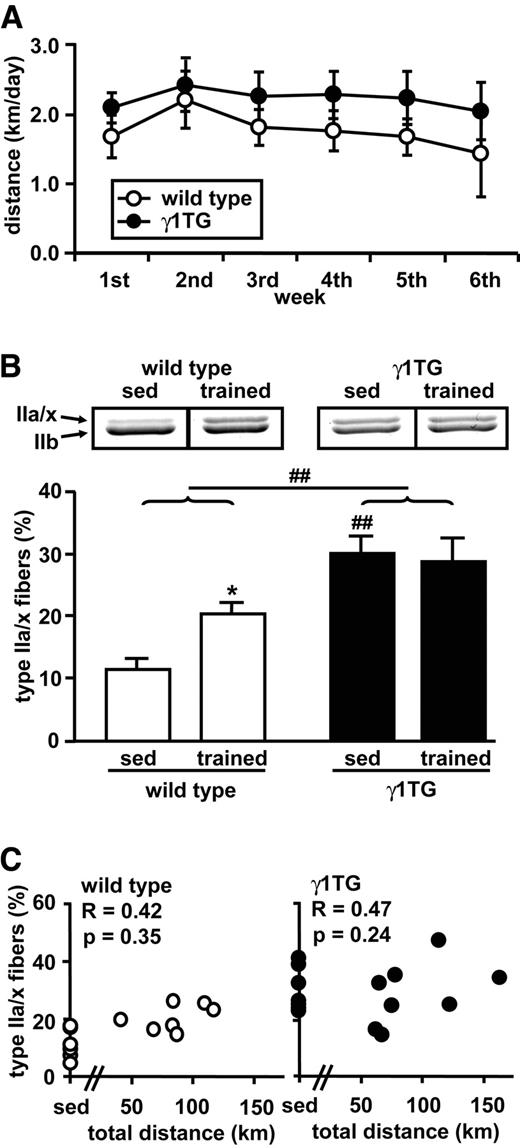 FIG. 2. MHC profile in wild-type and γ1TG muscle. The same experimental procedures as described for Fig. 1 were carried out using γ1TG mice and their wild-type littermates. The data are means ± SE. *P < 0.05 (versus sedentary); ##P < 0.01 (versus wild type for respective condition). sed, sedentary.