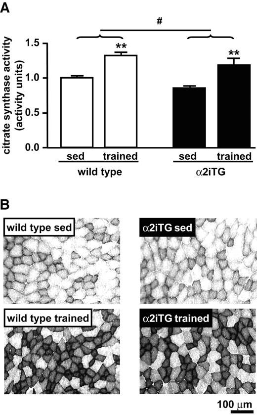 FIG. 3. Mitochondrial markers in sedentary and trained wild-type and α2iTG triceps muscle. Citrate synthase activity assays as well as succinate dehydrogenase staining were performed to assess differences in mitochondrial content between sedentary and trained wild-type and α2iTG muscle. A: Citrate synthase activity is expressed relative to wild-type sedentary (1.0 activity unit equals 487 ± 23 μmol · min−1 · g protein−1). Data are means ± SE. **P < 0.01 (versus sedentary); #P < 0.05 (versus wild type). B: Mid-belly cross-sections of triceps muscle were obtained and stained for succinate dehydrogenase activity. Note the marked difference in stain intensity between sedentary and trained muscle in both wild-type and α2iTG mice. sed, sedentary.