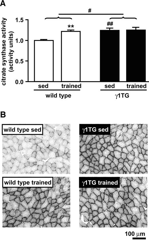 FIG. 4. Mitochondrial markers in sedentary and trained wild-type and γ1TG muscle. A: Citrate synthase activity is expressed relative to wild-type sedentary (1.0 activity unit equals 373 ± 22 μmol · min−1 · g protein−1). The data are means ± SE. **P < 0.01 (versus sedentary); #P < 0.05 (versus wild type); ##P < 0.01 (versus wild type for respective condition). B: Representative micrographs of mid-belly cross-sections of triceps muscle stained for succinate dehydrogenase activity. sed, sedentary.