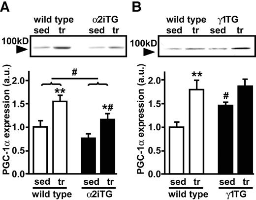 FIG. 5. PGC-1α protein expression. After 6 weeks of voluntary wheel cage running, triceps muscles of α2iTG (A) and γ1TG mice (B) were studied for PGC-1α protein expression by immunoblotting with anti-PGC-1α antibody. Data are means ± SE. *P < 0.05; **P < 0.01 (versus sedentary); #P < 0.05 (versus wild type for respective condition). sed, sedentary; tr, trained; a.u., arbitrary units.