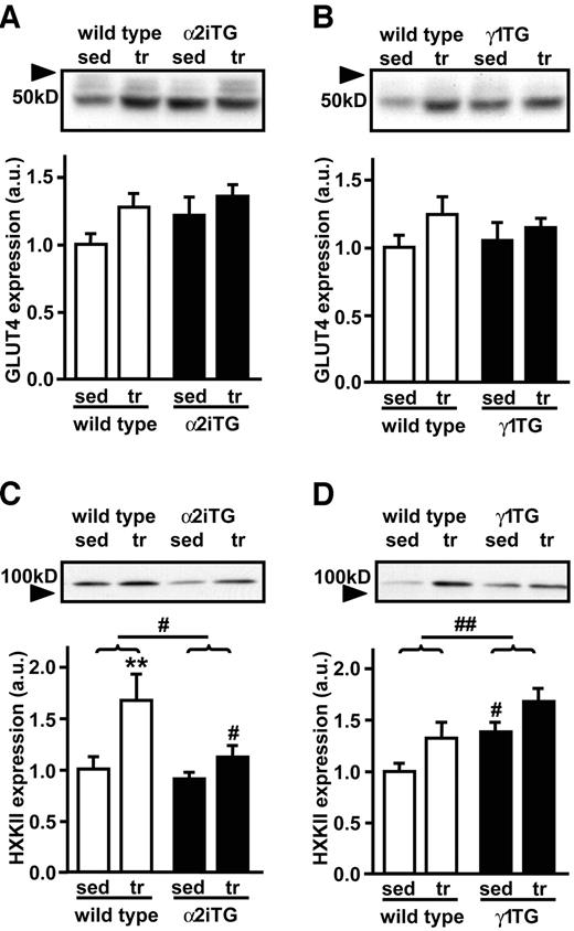 FIG. 6. GLUT4 and hexokinase II protein expression. After 6 weeks of voluntary wheel cage running, triceps muscle of α2iTG (A and C) and γ1TG mice (B and D) was studied for GLUT4 (A and B) hexokinase (C and D) protein expression by immunoblotting with anti–hexokinase II and anti-GLUT4 antibody. Data are means ± SEM. **P < 0.01 (versus sedentary); #P < 0.05; ##P < 0.01 (versus wild type). HXKII, hexokinase II; sed, sedentary; tr, trained; a.u., arbitrary units.