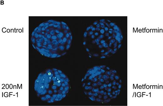 FIG. 3. Metformin reverses apoptosis in IGF-I–exposed blastocysts. A: Two-cell embryos were cultured in the same conditions as Fig. 1. Apoptosis was measured in individual blastocysts from each condition using the percentage of TUNEL-positive nuclei. Values with different letters were significantly different (P < 0.001). Control, n = 21; IGF-I, n = 28; IGF-I plus metformin, n = 28; metformin alone, n = 21. B: Immunofluorescent images of blastocysts described in A. Blue channel, nuclear dye; green channel, TUNEL reaction. (Please see http://dx.doi.org/10.2337/db07-0074 for a high-quality digital representation of this figure.)