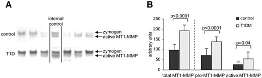 FIG. 2. MT1-MMP protein expression (means ± SE) in first-trimester placental tissue from control (n = 13) and type 1 diabetic (T1D) (n = 13) pregnancies. A: Six representative Western blots are shown. Before data analysis, all samples were normalized to the internal control (placenta extract). The graph (B) displays the expression of total MT1-MMP and separate expression of the pro–MT1-MMP zymogen (63 kDa) and the active MT1-MMP (57 kDa).