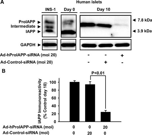 FIG. 2. Suppression of proIAPP expression in cultured human islets by transduction with Ad-hProIAPP-siRNA. Human islets were transduced with Ad-hProIAPP-siRNA (MOI 20) or Ad-Cont-siRNA (20) and cultured in CMRL (11.1 mmol/l glucose) for 10 days. A: Western blot analysis was performed on the human islet extracts (10 μg) followed by immunoblot using human IAPP antibody. IAPP (∼4 kDa) was the predominant IAPP-immunoreactive form in preculture human islets, whereas a partially processed form of proIAPP (∼6 kDa) was the major IAPP-immunoreactive form in human islets after 10-day culture. IAPP-immunoreactive forms in INS-1 cells (30 μg) are shown as control for different (pro)IAPP molecular species (left lane). B: Densitometric analysis of immunoblots. Transduction with Ad-hProIAPP-siRNA reduced (pro)IAPP immunoreactivity ∼75%. Results are presented as the percentage of IAPP-immunoreactive forms with (pro)IAPP immunoreactivity in nontransduced cultured islets taken as 100%. Data are expressed as means ± SE of three independent experiments. *Significantly different from transduced islets (P < 0.01, ANOVA).
