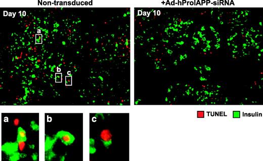 FIG. 5. siRNA-mediated suppression of human proIAPP expression decreases β-cell apoptosis. Double immunostaining for insulin (green) and TUNEL (red) of paraffin-embedded sections (5 μm) of human islets after 10-day culture that were either nontransduced (left) or transduced (right) with Ad-hProIAPP-siRNA (MOI 20). Double insulin/TUNEL-positive cells were observed in nontransduced and transduced human islet cultures but were more frequent in cultures transduced to express human IAPP siRNA. Higher magnification view (insets a, b, and c) shows insulin immunopositivity localized to cells with TUNEL-positive nuclei, demonstrating β-cell apoptosis. TUNEL-positive cells that are insulin negative were also frequently observed. (Please see http://dx.doi.org/10.2337/db08-0485 for a high-quality digital representation of this figure.)