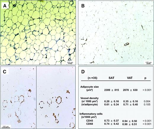 FIG. 1. Histological characteristics of SAT and VAT. Slides of adipose tissue samples were stained with toluidine blue for the measurement of adipocyte area (A), anti–von Willebrand antibody for the evaluation of vessel density (magnification ×50) (B), and anti-CD45 (left) and anti-CD68 (right) antibodies for the quantification of inflammatory infiltrate (magnification ×100) (C). D: Results obtained in 35 patients (n) are expressed as means ± SD and were compared by paired t tests. All significant differences between SAT and VAT were also significant in unpaired t tests (P < 0.05). (Please see http://dx.doi.org/10.2337/db07-1812 for a high-quality digital representation of this figure.)