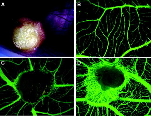 FIG. 3. In vivo angiogenesis induced by adipose tissue on CAM. Adipose tissue samples were layered on the CAM on day 8 of incubation and were observed between days 13 and 15. A: Macroscopic engulfment of adipose tissue sample. B: Normal angiographic aspect of CAM. C: Vascular attraction by adipose tissue on angiography. D: Angiographic aspect of covered sample with strong angiogenic stimulation. (Please see http://dx.doi.org/10.2337/db07-1812 for a high-quality digital representation of this figure.)