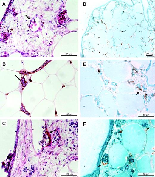 FIG. 5. Recruitment of human and avian endothelial cells. A–C: Adipose tissue samples layered on chick CAM from days 8 to 15 were stained with hematoxylin-eosin and an anti–human CD34 antibody. The arrows point to a CD34− vessel of the CAM (A) and to a CD34+ vessel in adipose tissue (B). B: See the nucleated chick erythrocytes inside the CD34+ vessels around adipocytes of successfully grafted adipose tissue. C: A CD34+ vessel buds from a CAM, CD34− vessel. D–F: Adipose tissue samples were layered on quail CAM for double staining of endothelial cells with anti–human CD34 antibody (in brown) and anti–quail-QH1 (in green) antibody that stains quail endothelial cells but does not cross-react with human endothelial cells. See the coexistence of human and quail vessels within the adipose tissue (D and E) and the presence (arrows) of both quail and human endothelial cells in the same vessels (E and F). (Please see http://dx.doi.org/10.2337/db07-1812 for a high-quality digital representation of this figure.)