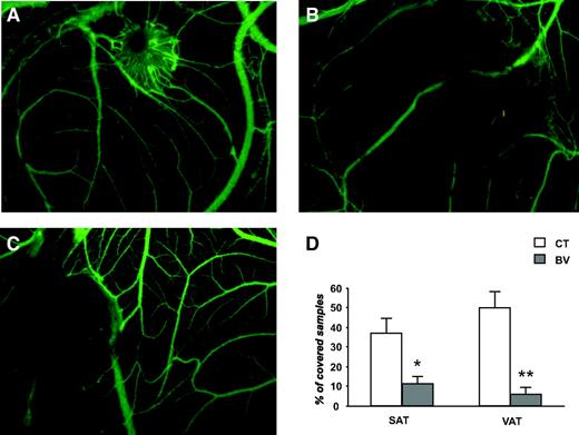 FIG. 6. Effect of VEGF inhibitors on angiogenesis associated with adipose tissue. SAT (n = 38) and VAT (n = 32) samples were layered on CAM on day 8. Angiographic observation was performed on day 15. Adipose tissue samples were incubated on days 9 and 10 with: vehicle (A), resulting in a typical angiogenic response with engulfment; 200 μmol/l PTK (B), resulting in inhibition of the angiogenic response both around the sample and on the CAM; or 300 μg/ml bevacizumab (C), resulting in inhibition of the angiogenic response around the sample. D: The percentages of covered SAT and VAT samples in controls incubated with vehicle (CT, □) and samples incubated with bevacizumab (BV, ▪). Bar graphs are 95% CI. *P < 0.05, **P < 0.01. (Please see http://dx.doi.org/10.2337/db07-1812 for a high-quality digital representation of this figure.)