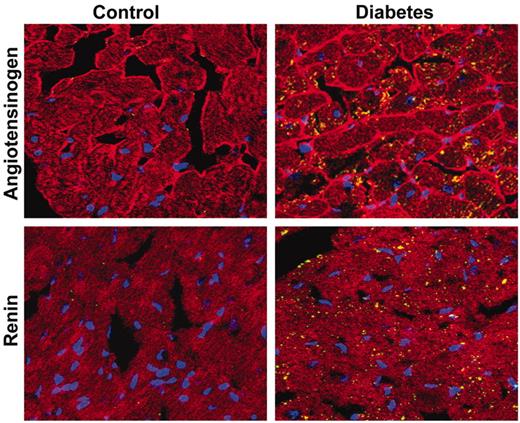 FIG. 2. Representative confocal immunofluorescence images of AGT and renin staining in hearts from control and diabetic rats. Pictures shown are merged images of staining for anti-sarcomeric actin (red), laminin (peripheral red staining in top), AGT (top) or renin (bottom) (green and yellow staining), and nuclei (blue). Magnification ×900. (Please see http://dx.doi.org/10.2337/db08-0805 for a high-quality digital representation of this figure.)