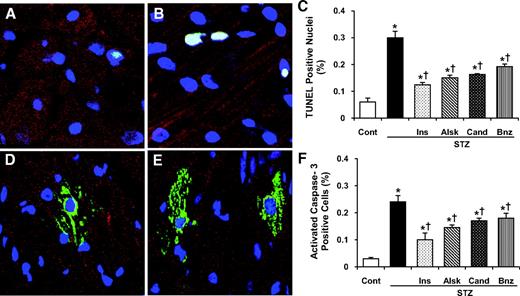 FIG. 4. Detection of apoptosis in cardiac myocytes by TUNEL assay and cleaved caspase-3 staining. A and B: TUNEL assay on heart sections from control (A) and diabetic (B) rats. D and E: Staining for cleaved caspase-3 in the hearts of control (D) and diabetic (E) rats. C and F: Quantification of TUNEL+ (C) and cleaved caspase-3+ (F) cells (∼25,000 cells were counted in each case). Values are expressed as means ± SE. *P < 0.05 vs. control, †P < 0.05 vs. diabetic rats without any treatment. (Please see http://dx.doi.org/10.2337/db08-0805 for a high-quality digital representation of this figure.)