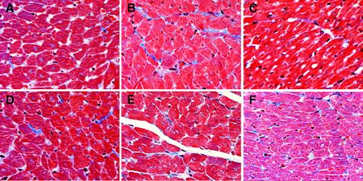 FIG. 5. Detection of cardiac fibrosis by Masson's Trichrome staining in heart sections from control rats (A); diabetic rats (B); and diabetic rats treated with insulin (C), aliskiren (D), candesartan (E), or benazepril (F). Representative images of five sections per heart and three hearts per group were observed with a ×40 objective. (Please see http://dx.doi.org/10.2337/db08-0805 for a high-quality digital representation of this figure.)