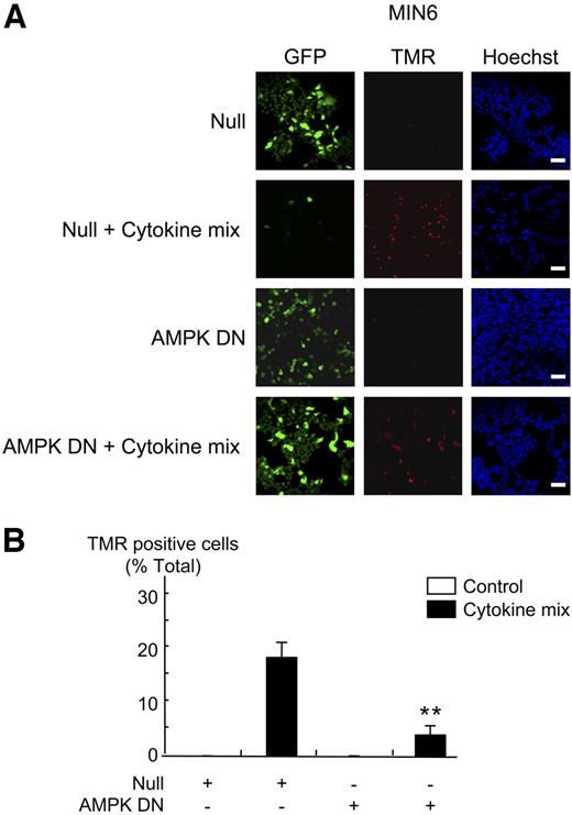 FIG. 4. Dominant-negative AMPK blocks cytokine-mediated apoptosis in MIN6 β-cells. A: MIN6 cells were infected with the indicated adenoviruses at 100 MOI (Null/GFP, AMPK-DN) for 48 h, before treatment with cytokines as in Fig. 1, for a further 48 h. Apoptosis was measured by TUNEL assay using the In Situ Cell Death Detection Kit, TMR Red, as described in research design and methods, followed by nucleus coloration with Hoechst dye. Results were analyzed by densitometry, and statistical differences were assessed by unpaired Student's t test. **P < 0.01 for the effects of AMPK-DN virus in the presence of cytokines compared with Null virus. B: The data from A given as means ± SEM of triplicate analyses from three independent experiments involving 100 individual cells per condition. Scale bar, 20 μm.