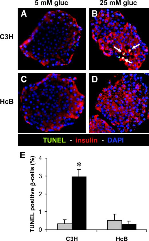 FIG. 4. Protection against glucose toxicity–induced β-cell apoptosis in TXNIP-deficient HcB-19 islets. Isolated primary islets of control C3H mice (A and B) and TXNIP-deficient HcB-19 mice (C and D) were again incubated at low (5 mmol/l) or high (25 mmol/l) glucose for 24 h and then analyzed by TUNEL. Representative pictures (×40) are shown, and white arrows point at bright appearing TUNEL-positive nuclei. E: For quantification >500 nuclei and at least 10 different islets were analyzed per group and condition and the percentage of TUNEL-positive β-cells per islet was calculated. Bars represent means ± SE. *P < 0.001 high vs. low glucose. , 5 mmol/l glucose; ▪, 25 mmol/l glucose.