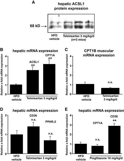 FIG. 3. Telmisartan induces hepatic PPARα target gene expression in diet-induced obese mice. C57BL/6J mice were fed a high-fat diet (HFD) (60% kcal from fat) for 16 weeks followed by 10 weeks treatment with vehicle, telmisartan (3 mg · kg−1 · day−1), or pioglitazone (10 mg · kg−1 · day−1). At the end of the treatment period, animals were dissected and organs were shock frozen in liquid nitrogen. A: Hepatic ACSL1 protein expression. A representative Western immunoblot is shown. B: Relative hepatic mRNA expression of ACSL1 and CPT1A in telmisartan-treated animals. **P < 0.01 vs. HFD vehicle. C: mRNA expression of CPT1B in skeletal muscle tissue of telmisartan-treated animals. n.s., statistically not significant versus HFD vehicle animals. D: Relative hepatic mRNA expression of CD36 and PPARγ2 in telmisartan-treated animals. n.s., statistically not significant versus HFD vehicle animals. E: Relative hepatic mRNA expression of CPT1A and CD36 in pioglitazone-treated animals. n.s., statistically not significant versus HFD vehicle animals. **P < 0.01 vs. HFD vehicle. Expression was normalized to 18S expression. Experiments were repeated four times and results are presented as x-fold induction over vehicle-treated cells. Mean ± SE is shown.