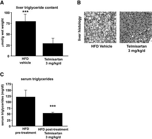 FIG. 4. Telmisartan reduces hepatic and serum triglycerides in diet-induced obese mice. A: Liver triglyceride content of telmisartan- and vehicle-treated animals on high-fat diet (HFD) in μmol/g wet weight. ***P < 0.005. B: Hematoxylin-eosin staining of representative liver sections from vehicle and telmisartan HFD-fed mice. C: Serum triglycerides in HFD-fed mice before and after telmisartan treatment. ***P < 0.005 pre- versus posttreatment.