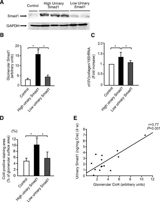 FIG. 3. Glomerular expression of Col4 at 4 weeks after STZ injection. A: Immunoblots for Smad1 in control and diabetic rats at 4 weeks are shown. Proteins (20 μg) obtained from each glomerular lysates were loaded. Each lane represents a representative Western blot for the glomerular lysates from each rat. B: Quantification of glomerular Smad1 by optical densitometry. The data are expressed as means ± SD. C: Glomerular mRNA gene expression for Col4a1 was measured by real-time RT-PCR. The data are expressed as means ± SD. D: Morphometric analysis of the glomerular expression of Col4. The glomerular staining area of Col4 was measured as described in research design and methods. The data are expressed as means ± SD. High urinary Smad1: data from the rats in which urinary Smad1 at 4 weeks was equal or higher than the median. Low urinary Smad1: data from the rats in which urinary Smad1 at 4 weeks was lower than the median. *P < 0.05. E: The correlation between glomerular expression of Col4 (arbitrary units obtained from band intensity of immunoblots) and urinary Smad1.