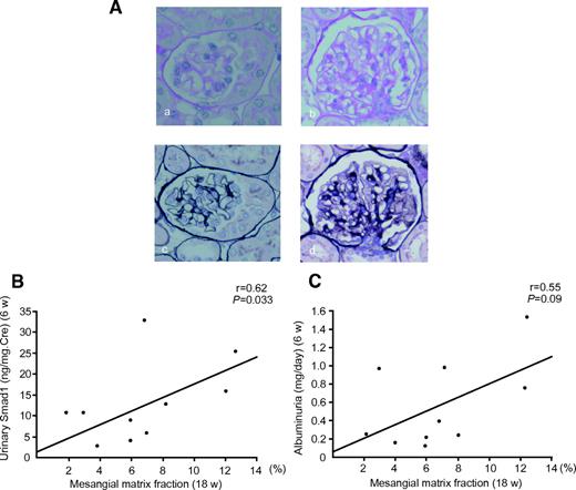 FIG. 5. Association of urinary Smad1 with glomerular expansion in db/db mice. A: Representative light microscopic appearance of glomeruli (PAS and PASM staining) for db/m mice (a and c) and db/db mice (b and d). a and b: PAS staining. c and d: PASM staining. The original magnification was ×400. B: The correlation between urinary Smad1 at 6 weeks and mesangial matrix fraction at 18 weeks is shown (r = 0.62, P = 0.033). C: Correlation between albuminuria and mesangial matrix fraction at 18 weeks (r = 0.55, P = 0.09).