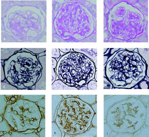 FIG. 6. Olmesartan ameliorates mesangial matrix expansion. Representative light microscopic appearance of glomeruli (PAS and PASM staining) and immunohistochemistry of Col4 for control rats (a, d, and g), diabetic rats (b, e, and h), and diabetic rats with olmesartan (c, f, and i). a and c: PAS staining. d and f: PASM staining. g–i: Col4. The original magnification was ×400.