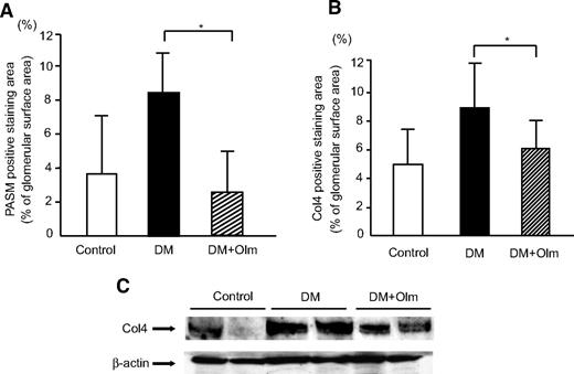 FIG. 7. Olmesartan ameliorates mesangial matrix expansion. A: Morphometric analysis of PASM positive staining area. *P < 0.05. B: Morphometric analysis of the glomerular expression of Col4. *P < 0.05. C: Immunoblots for Col4 in control and diabetic rats at 24 weeks are shown. Proteins (20 μg) obtained from each glomerular lysates were loaded. Each lane represents a representative Western blot for the glomerular lysates from each rat. Control, control rat; DM, STZ-induced diabetic rat with vehicle; DM+Olm, STZ-induced diabetic rats treated with olmesartan.