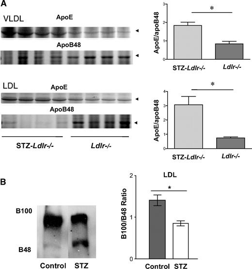 FIG. 2. ApoB and apoE in plasma VLDL and LDL. Lipoproteins were isolated by sequential ultracentrifiguation. A: VLDL and LDL were isolated by ultracentrifugation using an equal volume of plasma. ApoE was analyzed by 4–20% and apoB48 4% SDS-PAGE, respectively. ApoE/apoB48 was determined by densitometric scanning. B: Thirty micrograms of protein were loaded into a 4% gel, transferred to nitrocellulose, and blotted using antibodies to apoB. A representative blot is shown on the left, and average B100/B48 ratio in LDL (n = 3–4) is shown on the right.