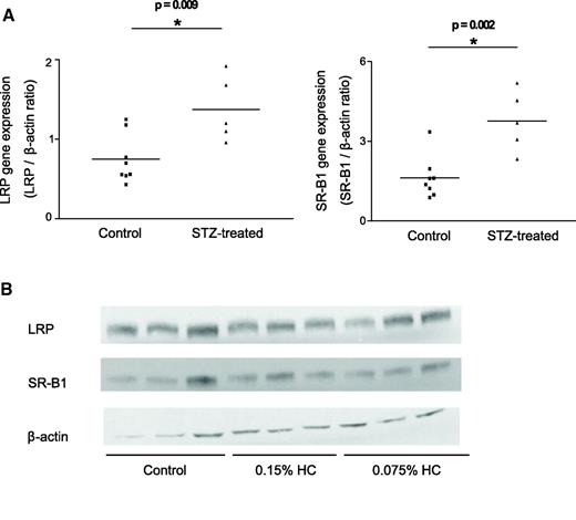 FIG. 4. Expression of lipoprotein receptors in control and STZ-induced diabetic mice. Livers from control and STZ-induced diabetic mice were used for mRNA analysis and protein expression by Western blot analysis. A: Real-time PCR measurements of LRP and SR-BI. B: Western blots. HC, high-cholesterol diet.