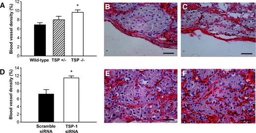 FIG. 4. Vascular density in renal subcapsular islet grafts 1 month posttransplantation. A: Percentage of islet area constituted by blood vessels in islet grafts composed of wild-type (▪), TSP-1+/− (▒), or TSP-1−/− (□) islets. *P = 0.046 when compared with wild-type islets. B and C: Micrographs of islet grafts composed of wild-type (B) or TSP-1−/− (C) islets stained with the endothelial marker BS-1 (red). D: Percentage of islet area constituted by blood vessels in islet grafts composed of scramble (▪) or TSP-1 siRNA-transfected (□) islets. *P = 0.016 when compared with scramble siRNA-transfected islets. E and F: Micrographs of islet grafts composed of scramble (E) or TSP-1 (F) siRNA-transfected islets. Values in A and D are means ± SE for five to eight (A) and four experiments in each group, respectively. Scale bars in micrographs are 50 μm.