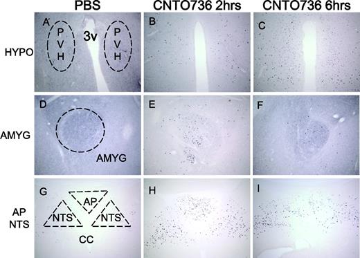 FIG. 6. Peripheral treatment of CNTO736 leads to neuronal activation of several brain areas as measured by c-fos immunohistochemical staining. Brain sections from rats (n = 3) dosed intravenously with PBS (A, D, and G), CNTO736 for 2 h (B, E, and H), and CNTO736 for 6 h (C, F, and I). Brain sections were taken at the level of the hypothalamus (HYPO) (A–C), central nucleus of the amygdale (AMYG) (D–F), area postrema (AP), and nucleus of the solitary tract (NTS) (G–I). The images are representative of sections taken from three rats per group. Coronal brain sections were stained with an anti–c-fos antibody. All pictures were taken at a ×10 magnification. Staining of PBS-treated animals at 2 and 6 h postinjection were identical. PVH, paraventricular nucleus of the hypothalamus.