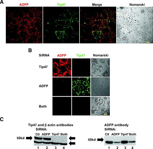FIG. 1. Identification and downregulation of all PAT proteins (ADFP and Tip47) in AML12 cells. A: Cells were incubated with 400 μmol/l oleic acid for 12 h before staining. Cells were costained with a polyclonal goat anti-ADFP antibody and with a rabbit polyclonal anti-Tip47 antibody and, respectively, alexa fluor 488–or 594–conjugated secondary antibodies. Fluorescent and phase images were generated by an LSM 510 confocal laser microscope. Bar represents 50 μm. B: Coimmunostaining with ADFP and Tip47 of AML12 cells treated for 4 days with siRNA ADFP, siRNA Tip47, both combined, or control. Cells were treated as above. C: Immunoblots of total cellular protein extract from AML12 cells treated with control siRNA (Qiagen) (lane 1); siRNA ADFP (lane 2); siRNA Tip47 (lane 3); or both combined (lane 4). Rabbit polyclonal anti-Tip47, anti-ADFP, and anti–β-actin antibodies were used as loading control. (Please see http://dx.doi.org/10.2337/db07-1383 for a high-quality digital representation of this figure.)
