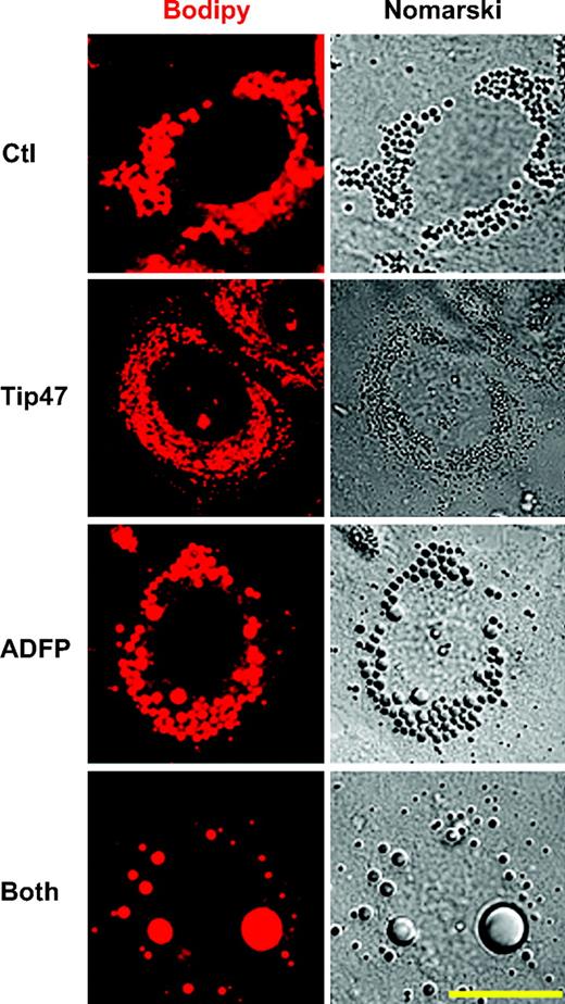 FIG. 2. Morphological differences in AML12 cells following downregulation of PAT proteins. Cells were stained with bodipy fl568, which preferentially stained neutral lipid. Fluorescent and phase images were generated by a LSM 510 confocal laser microscopy. Bar represents 50 μm. (Please see http://dx.doi.org/10.2337/db07-1383 for a high-quality digital representation of this figure.)