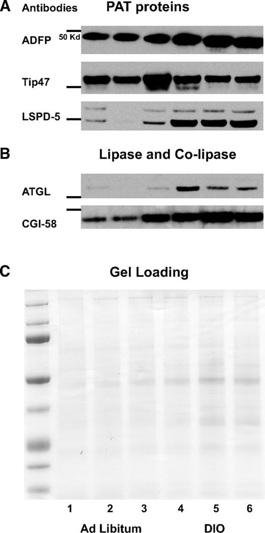 FIG. 8. Content of PAT proteins in DIO mice liver fat cake appears insufficient to protect the LD against the presence of increased ATGL. Fat cakes extracted from three pooled liver tissues from eight mice fed ad libitum or nine DIO mice were loaded in lanes 1–3 or lanes 4–6, respectively. Fat cakes were isolated by ultracentifugation, 10-μl aliquots used for protein determination following cold acetone precipitation overnight, and the protein pellets washed. Equal amounts of total protein were loaded but for ADFP, and 1/20 dilution was performed before loading the samples to avoid overexposed blots.