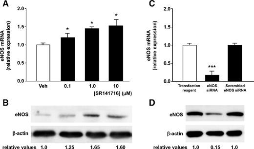 FIG. 1. The CB1 receptor antagonist SR141716 dose-dependently upregulates eNOS expression in cultured white adipocytes. A and B: eNOS mRNA and protein, analyzed by quantitative RT-PCR and immunoblotting, respectively, in vehicle-treated cells (0.02% DMSO) (Veh) or after exposure to different doses of SR141716 for 3 days. The cycle number at which the transcript was detectable was compared with that of β-actin and expressed as relative expression versus values in vehicle-treated cells taken as 1.0 (n = 5 experiments) (*P < 0.05 vs. vehicle). eNOS protein was detected by immunoblot analysis (in B, one experiment representative of five reproducible ones). The numbers below the blots show the relative values from the densitometric analysis, relative to β-actin levels, when control (vehicle) measurement is given a value of 1.0. C and D: eNOS expression in white adipocytes transfected with either 100 nmol/l scrambled control siRNA or eNOS siRNA and harvested 48 h later. eNOS mRNA and protein levels were measured by means of quantitative RT-PCR and immunoblotting (n = 3 experiments) (***P < 0.01 vs. transfection reagent-treated cells). All data represent means ± SE.