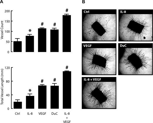 FIG. 2. Duct cells induce neogenesis of blood vessels in rat aortic ring assay. Isolated rat aortic rings were incubated for 10 days in control medium (Ctrl) or medium with recombinant human IL-8 (1 ng/ml), recombinant human VEGF-A165 (20 ng/ml), a combination of both, or with 24-h duct cell–conditioned medium (DuC). At day 10, rings were photographed. Total vessel numbers were counted and total vessel lengths were measured as described in research design and methods. A: Values are the average of three aortic rings per condition ± SE. P value vs. carrier alone (Ctrl); *P ≤ 0.05; #P ≤ 0.001. Results come from at least three independent experiments. Representative photographs of each condition are shown in B.