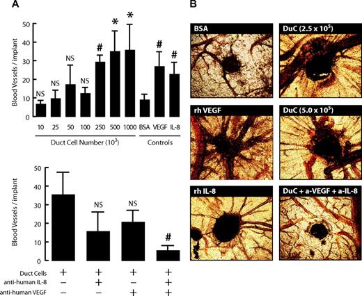FIG. 3. Duct cells induce neogenesis of blood vessels in the CAM assay. Duct cells were grafted on CAMs at indicated concentrations with or without anti-human IL-8 and anti-human VEGF neutralizing antibodies. BSA (50 μg/embryo) was used as negative control and recombinant human IL-8 (5 μg/embryo) and VEGF (5 μg/embryo) as positive controls. At day 13, the region around the implant was photographed. Values are the average of three implants per condition ± SE (of five independent experiments). P vs. negative control (50 μg/embryo; 0.1% BSA) (A, upper panel); P vs. 2.5 × 105 duct cell condition (A, lower panel). *P ≤ 0.05; #P ≤ 0.001. Representative photographs are shown in B. (Please see http://dx.doi.org/10.2337/db07-1705 for a high-quality digital representation of this figure.)