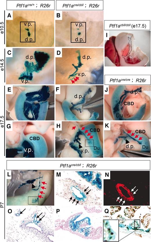 FIG. 2. Cell fate conversion of pancreatic precursors into the CBD and duodenal cells in hypomorphic Ptf1acre/cbll mice. A–L: Macroscopic views of pancreatic regions stained with X-gal. Hypomorphic pancreas is observed from the beginning of pancreatic bud formation at e10.5 (B) and becomes more apparent as development proceeds to e14.5 (D) and e17.5 (F and H) in Ptf1acre/cbll;R26r mice. Broken lines in (I) delineate moderate hypoplastic pancreas in Ptf1acbll/cbll mice at e17.5. Note that substantial proportions of the Ptf1a lineage-labeled cells are ectopically observed in the CBD (red arrows in H) and the duodenum (Du) (outlined boxes in H and L) in Ptf1acre/cbll;R26r mice at e17.5 (H) and P7 (L). Endogenous β-gal activity is observed in the duodenum as background. The cell fate conversion to the CBD is observed in Ptf1acre/cbll;R26r mice as early as e14.5 (red arrows in D). Ectopic Ptf1a lineage-labeled areas are also observed in the CBD and duodenum in Ptf1acre/cre;R26r mice at e17.5 (J and K). M–Q: Histological analyses of Ptf1acre/cbll;R26r mice at P7. Substantial proportions of Ptf1a lineage-labeled cells are misspecified and located to the CBD epithelium (arrows in M and N [M and N are the same sections]), including the peribiliary glands (arrows in O) and duodenal epithelial cells (P) stained with hematoxylin and eosin, which are positive for cytokeratin (red; arrow in N) and the intestinal marker Cdx2 (brown; Q), respectively, in Ptf1acre/cbll;R26r mice. (Please see http://dx.doi.org/10.2337/db07-1558 for a high-quality digital representation of this figure.)