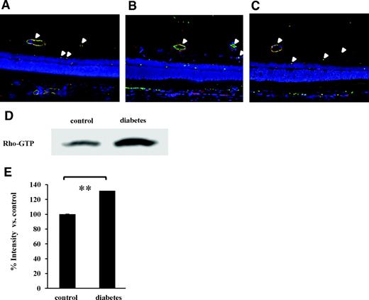 FIG. 1. Localization and activity of Rho/ROCK in retinal vessels. Paraffin-embedded sections of nondiabetic rat retinas were immunohistochemically analyzed with RhoA (A), ROCK1 (B), and ROCK2 (C) antibodies (magnification ×400). Endothelial cells were stained with rhodamin-conjugated anti-CD34 (red). RhoA, ROCK1, and ROCK2 were detected by green fluorescence. Yellow (white arrowhead) indicates double-stained vasculature. D: Representative blot showing the level of ρ-GTP in nondiabetic control or STZ-induced diabetic rat retinas detected by Rho pull-down assay. E: Average signal intensities quantified and expressed as percentage of the ratio of control (**P < 0.01, n = 5 each). (Please see http://dx.doi.org/10.2337/db08-0762 for a high-quality digital representation of this figure.)