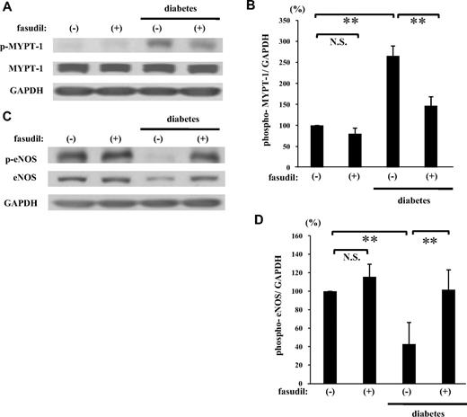 FIG. 2. Impact of intravitreal fasudil on retinal ROCK activity. Phosphorylated MYPT-1 (Thr853) and eNOS (Ser1177) were detected in rat retinal preparations by Western blot analysis. Lane loading differences were normalized by reblotting the membranes with an antibody against GAPDH. A: Representative results of phospho-MYPT-1 and GAPDH in rat retinas. B: ROCK activity was expressed as the ratio of phospho-MYPT-1 to GAPDH (**P < 0.01, NS; n = 6 each). C: Representative results of phospho-eNOS and GAPDH. D: Average signal intensities quantified and expressed as percentage of the ratio of control (**P < 0.05, NS; n = 6 each).