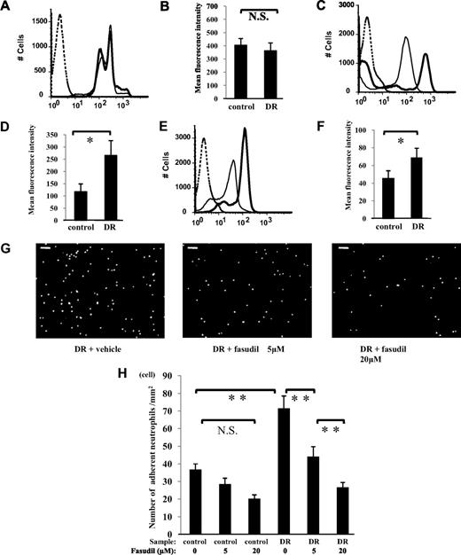 FIG. 5. Reduced adhesion of neutrophils from diabetic retinopathy patients to HMVECs by fasudil. Cell surface expressions of CD11a (A), CD11b (C), and CD18 (E) on neutrophils from nondiabetic control subjects (thin line) and those with diabetic retinopathy (DR) (thick line) were analyzed by flow cytometry. Mean fluorescence intensity of CD11a (B), CD11b (D), CD18 (F) (*P < 0.05, NS; n = 20 each; dotted line, mouse isotype control). G and H: Confluent HMVECs in collagen-coated 24-well plates were pretreated with 0, 5, or 20 μmol/l fasudil for 1 h and subsequently stimulated with 10 ng/ml rhTNF-α for 12 h. Labeled neutrophils (1 mmol/l Calcein-AM) were coincubated (2 × 105 cells/ml, 500 μl/well) with pretreated HMVECs for 1 h at 37°C. Scale bar = 100 μm. The number of adherent neutrophils in four different areas per well was counted and averaged (**P < 0.01, NS; n = 15 each).
