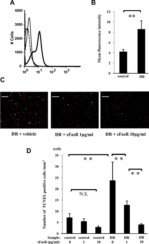 FIG. 6. Fas/FasL-mediated endothelial apoptosis by adherent neutrophils. A: Cell surface expressions of FasL on neutrophils from nondiabetic control subjects (thin line) and diabetic retinopathy (DR) patients (thick line) were analyzed by flow cytometry. B: Mean fluorescence intensity of FasL (**P < 0.05, n = 17 each; dotted line, mouse isotype control). C and D: HMVECs were labeled with 1 mmol/l Hoechst 33342 (red fluorescence). HMVECs were stimulated for 12 h with 10 ng/ml rhTNF-α. Neutrophils were incubated with 0, 1, and 10 μg/ml sFas receptor (sFasR) before coculture for 1 h. Subsequently, unlabeled neutrophils (5 × 105cells/ml) from nondiabetic control subjects or diabetic retinopathy patients were cocultured with HMVECs for 12 h. Apoptotic HMVECs demonstrated double labeling and appeared yellow. Scale bar = 100 μm. The number of TUNEL-positive cells in four different areas per well was counted and averaged (**P < 0.01, NS; n = 5 each). (Please see http://dx.doi.org/10.2337/db08-0762 for a high-quality digital representation of this figure.)