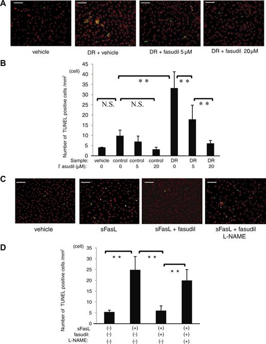 FIG. 7. Prevention of neutrophil-induced endothelial apoptosis by fasudil. A and B: After pretreatment with 0, 5, or 20 μmol/l fasudil for 1 h, HMVECs were stimulated for 12 h with 10 ng/ml rhTNF-α. Subsequently, unlabeled neutrophils (5 × 105cells/ml) were cocultured with HMVECs for 12 h. Scale bar = 100 μm. The number of apoptotic cells (yellow fluorescence) in four different areas per well was counted (**P < 0.01, NS; n = 15 each). C and D: Involvement of fasudil in sFasL-induced apoptosis was investigated. HMVECs were preincubated with or without 20 μmol/l fasudil before sFasL treatment for 1 h. Furthermore, HMVECs were incubated with or without 1 mmol/l l-NAME before fasudil treatment for 1 h. Scale bar = 100 μm. The number of TUNEL-positive cells in four different areas per well was counted and averaged (**P < 0.01, NS; n = 4 each). (Please see http://dx.doi.org/10.2337/db08-0762 for a high-quality digital representation of this figure.)
