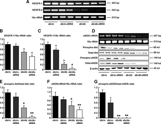 FIG. 2. RT-PCR for VEGF-R1, VEGF-R2 (A), eNOS (D) mRNA, and 18s rRNA expression in the hearts of diabetic db/db and nondiabetic db/m mice with or without dRK6 treatment. Quantitative assessment of the expression of VEGF-R1 (B), VEGF-R2 mRNA (C), and eNOS mRNA (F) to 18s rRNA ratios in the hearts of the study groups. Western blot analysis of the total and phospho-Akt and phospho-eNOS (D) and quantitative assessment of the expression of total and phospho-Akt (E) and phospho-eNOS protein (G). *P < 0.05 compared with other groups, **P < 0.01 compared with other groups, #P < 0.05 compared with the db/db group, +P < 0.05 compared with the db/m group; n = 4.