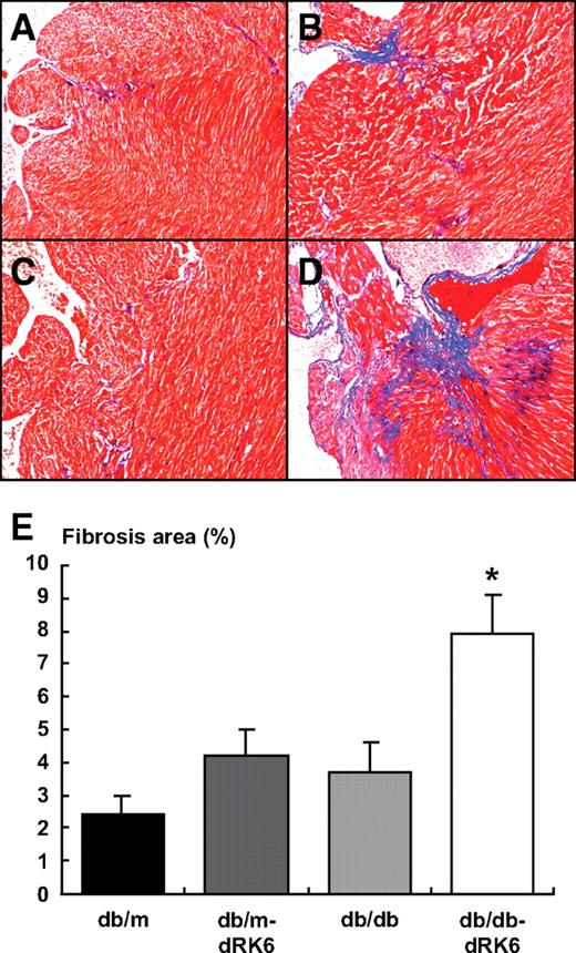 FIG. 3. Cardiac histopathology in diabetic db/db and nondiabetic db/m mice with or without dRK6 treatment (Trichrome stain, ×100). The histopathology shows marked cardiac fibrosis in diabetic db/db-dRK6 (D) compared with nondiabetic db/m and db/m-dRK6 mice (A and B) and db/db control mice (C). Original magnification ×200. Quantitative assessment of the areas of fibrosis in the myocardial tissue of the study groups (E). *P < 0.01 compared with the other groups; n = 4. (A high-quality color digital representation of this figure is available in the online issue.)