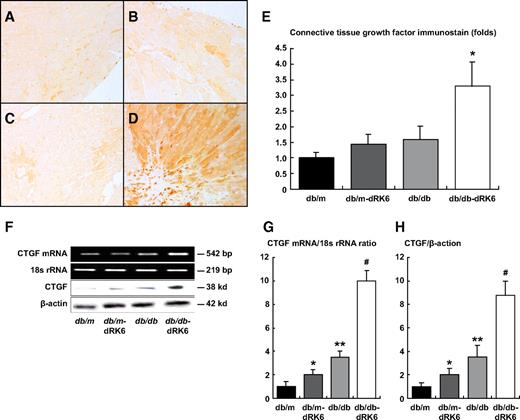 FIG. 4. Immunohistochemical staining for CTGF in the myocardial tissue of nondiabetic db/m and diabetic db/db mice (B and D, respectively) with or without dRK6 treatment (A and C, respectively; ×200). Original magnification ×200. E: Quantitative assessment of CTGF immunostaining in the myocardial tissue of the study groups. F: Expression of CTGF protein, mRNA, and 18s rRNA in the hearts of the study groups. Quantitative assessment of the expression of CTGF mRNA (G) and protein (H). *P < 0.05, **P < 0.01 compared with the other groups, #P < 0.01 compared with the db/db group; n = 4. (A high-quality color digital representation of this figure is available in the online issue.)